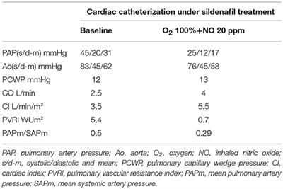 Vasoreactive Pulmonary Arterial Hypertension Manifesting With Misleading Epileptic Seizure: Diagnostic and Treatment Pitfalls